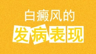 晚期白癜风的症状是什么?