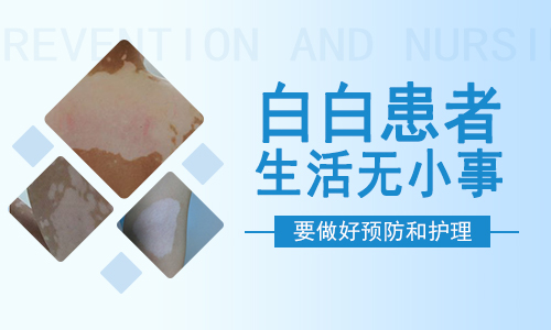 晚期白癜风的症状是什么？